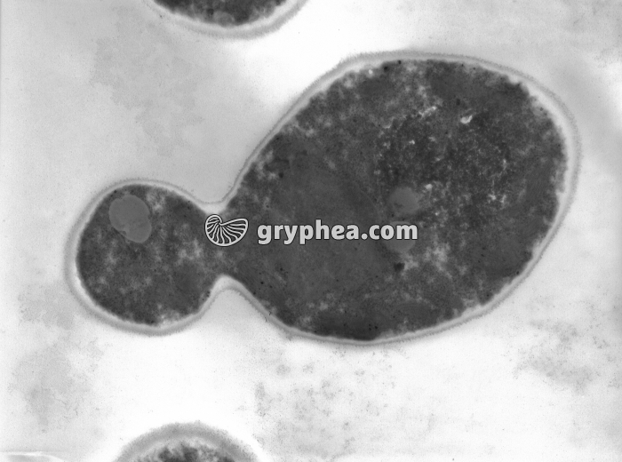 Levure au MET - gryphea.com